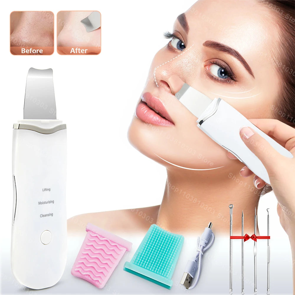 Rechargeable Facial Ultrasonic Cleansing Appliance Skin Scrubber Facial Exfoliation Blackhead Remover Facial Scraper Pimple Extractor Facial Deep Cleansing Machine Facial Care That Also Features Blackhead Remover