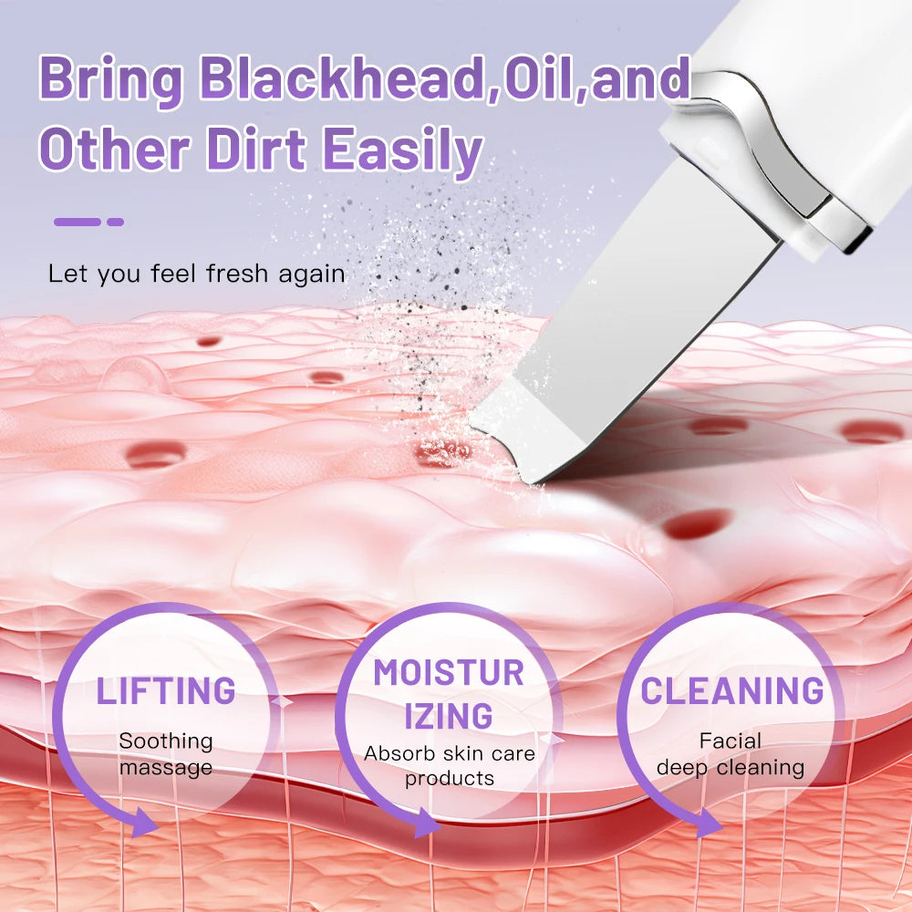 Rechargeable Facial Ultrasonic Cleansing Appliance Skin Scrubber Facial Exfoliation Blackhead Remover Facial Scraper Pimple Extractor Facial Deep Cleansing Machine Facial Care That Also Features Blackhead Remover