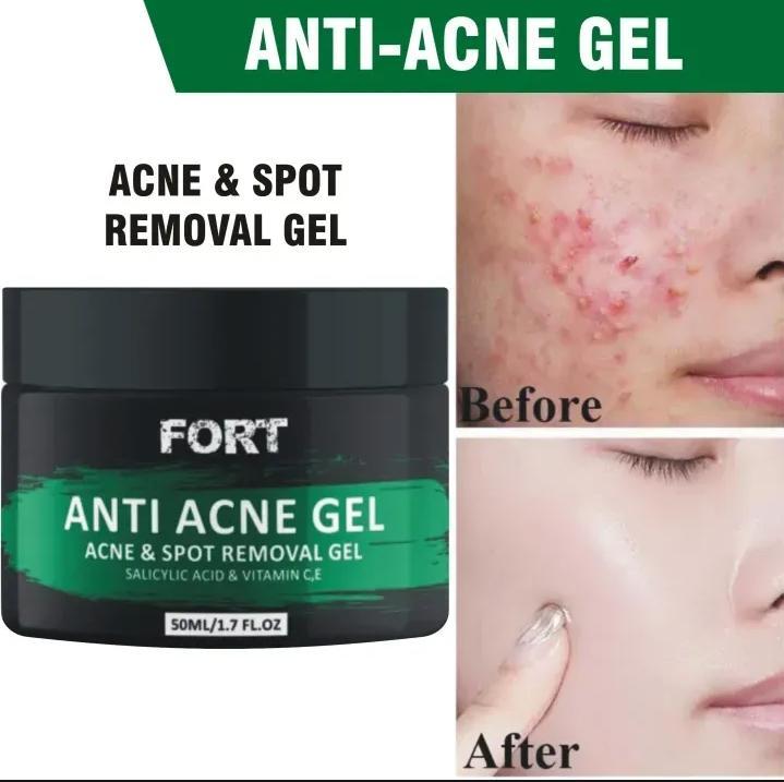 Fort Anti Acne Gel For Acne & Spot Removal With Salicylic Acid & Vitamin C,E | Anti Acne Face Treatment Gel | 50ml