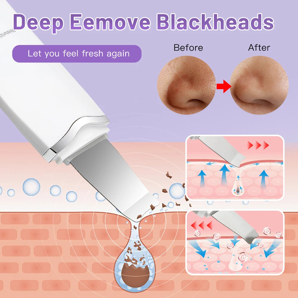 Rechargeable Facial Ultrasonic Cleansing Appliance Skin Scrubber Facial Exfoliation Blackhead Remover Facial Scraper Pimple Extractor Facial Deep Cleansing Machine Facial Care That Also Features Blackhead Remover